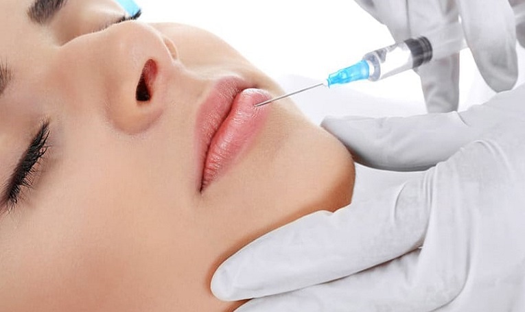 تزریق ژل لب در اندیشه فاز یک
