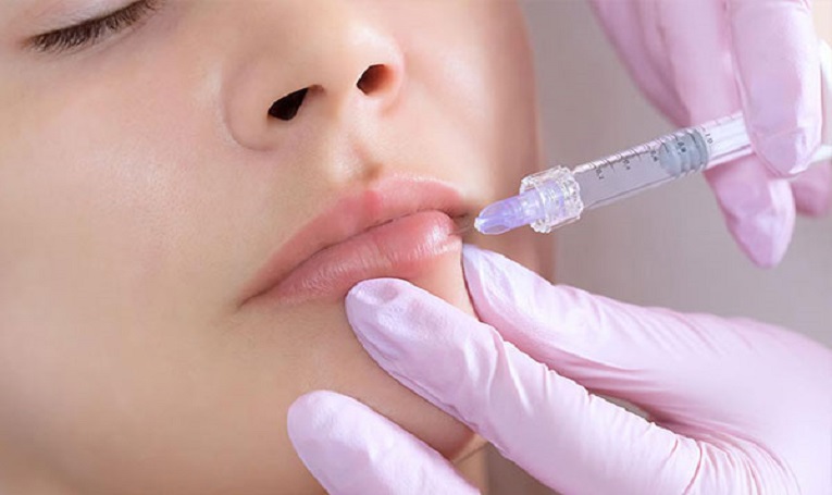 تزریق ژل لب روسی در شهرک وائین شهریار