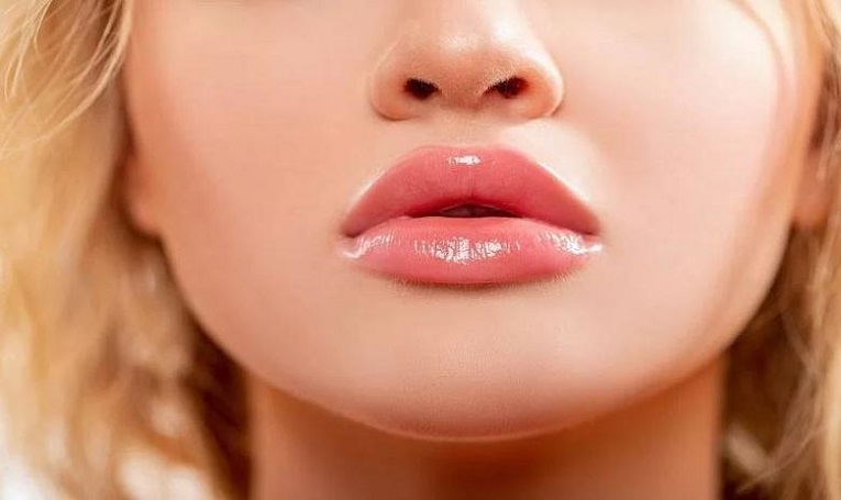 تزریق ژل لب روسی در شهر قدس
