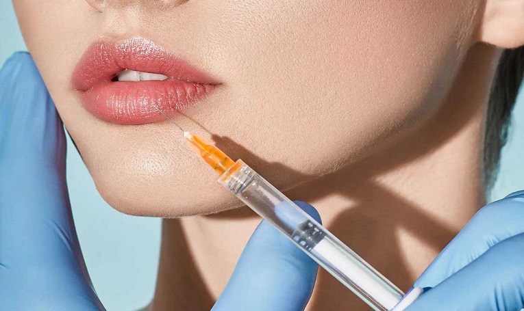 تزریق ژل لب روسی در شهریار